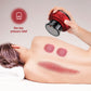 Electric Vacuum Cupping Massage Body